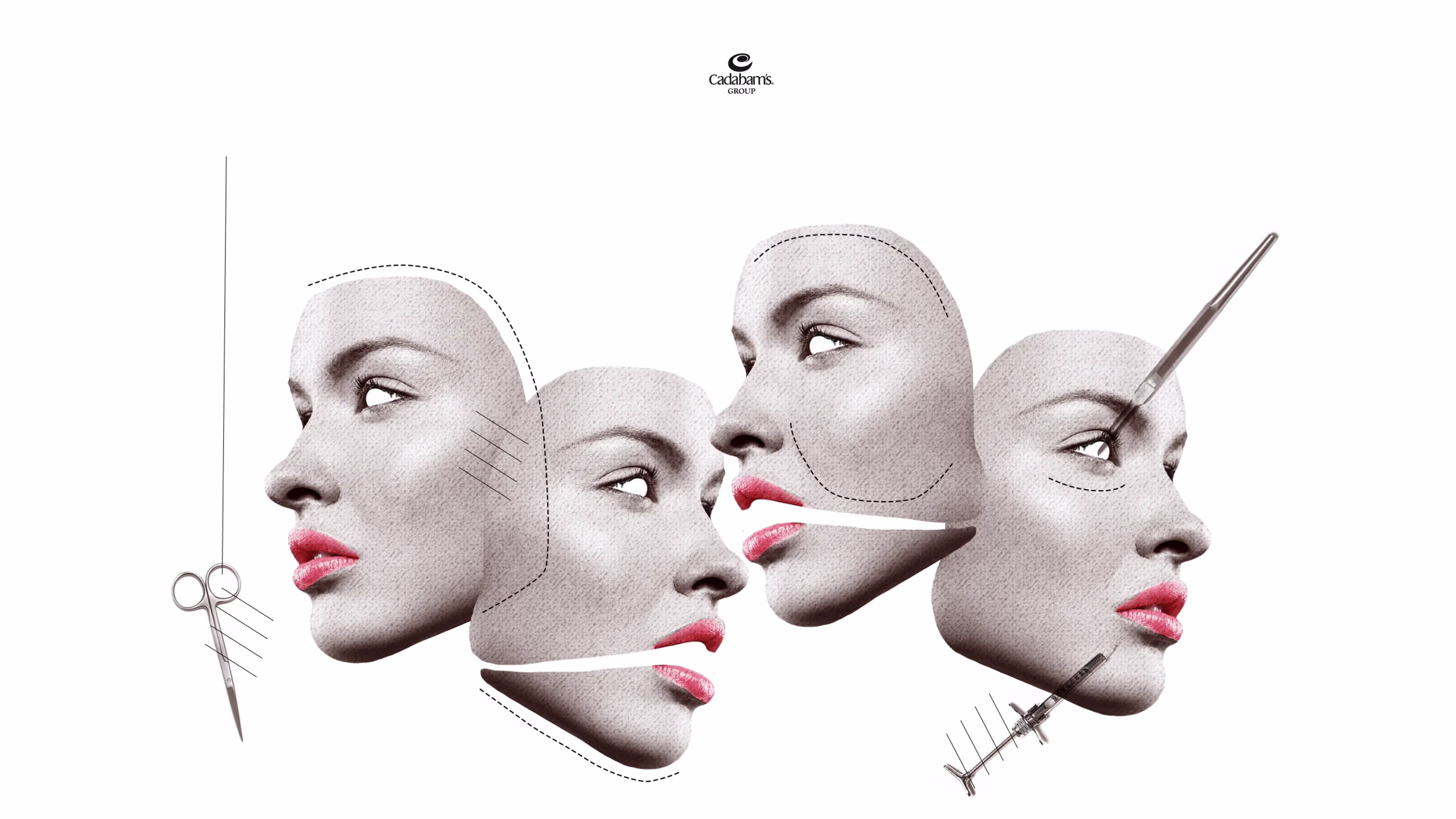 Cosmetic Surgery Disorder